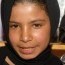 Йемений охидын 25 хувь нь насанд хүрэхээсээ өмнө хадамд гардаг